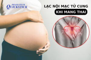 lạc nội mạc tử cung có thai được không